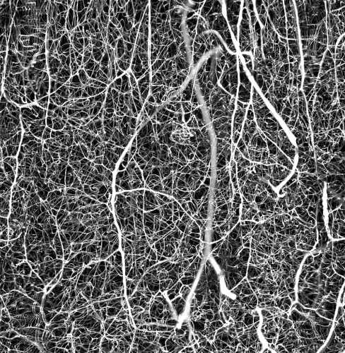 an illustration of nuerons in the brain